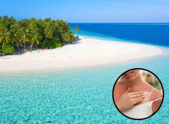 Vacanza isola, sole pericoloso