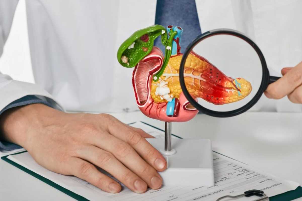 Tumore al pancreas, sintomi
